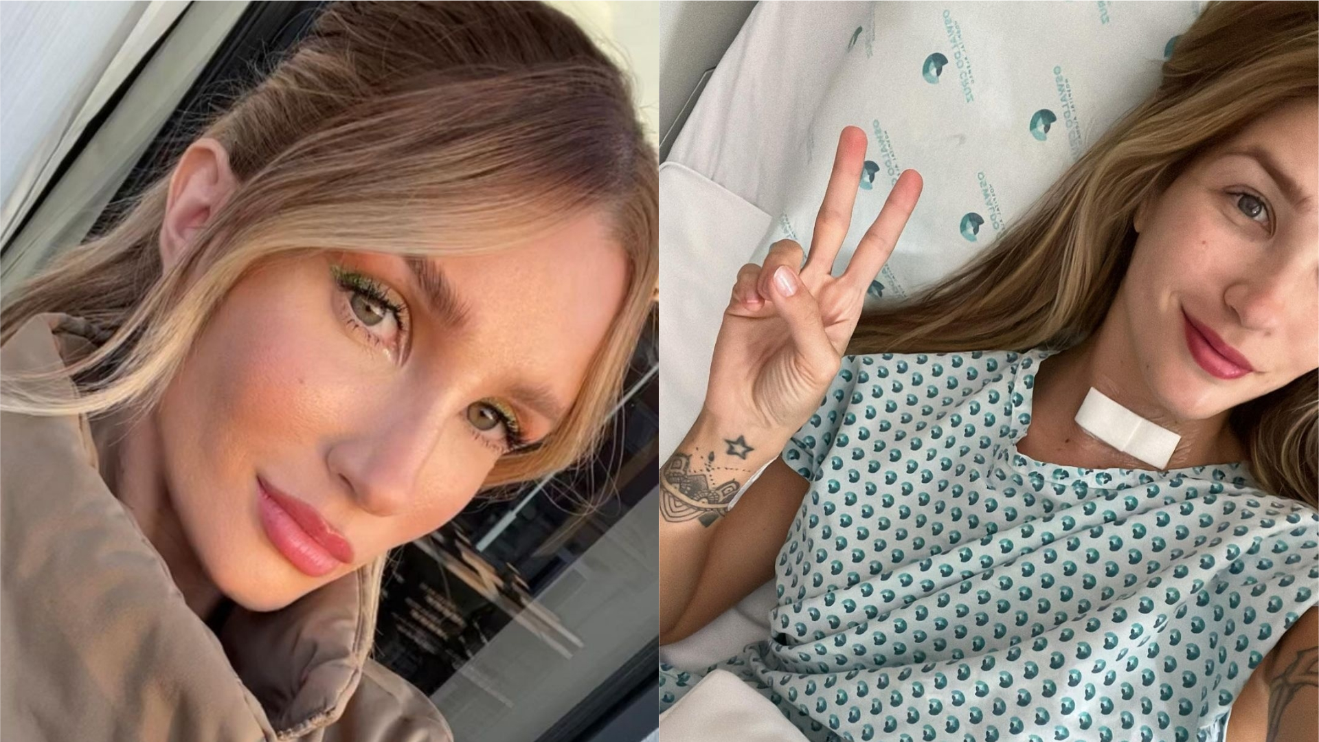 Aline Gotschalg fala sobre tratamento de câncer: “Muita ansiedade”