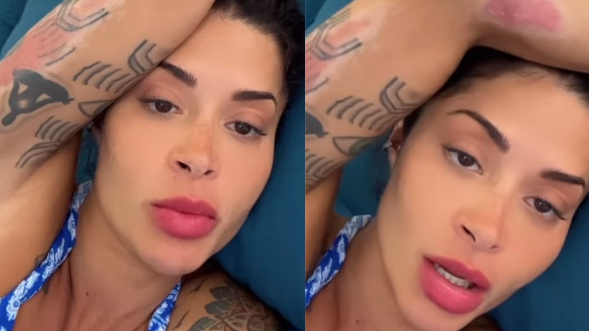 Aline Campos mostra pela primeira vez as cicatrizes do grave acidente que sofreu: “Pior dor que já senti!”