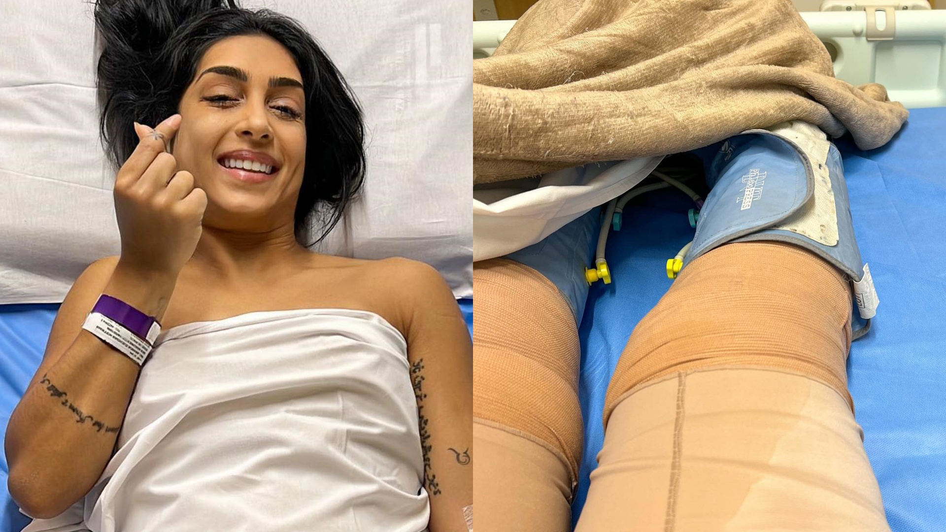 Amanda Djehdian passa por cirurgia após diagnóstico de lipedema: “As dores vão passar”