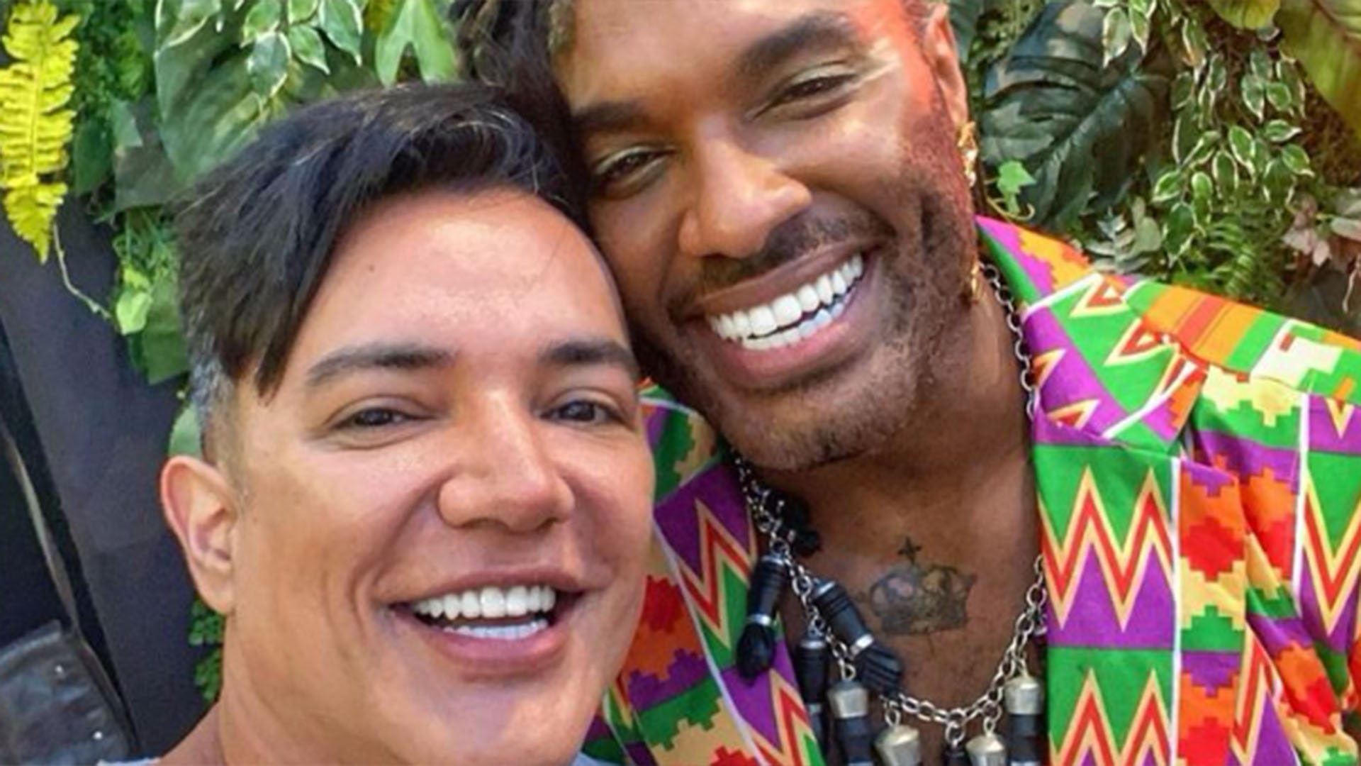 BBB 23: Marido de Fred Nicácio exibe antes e depois do queixo do amado