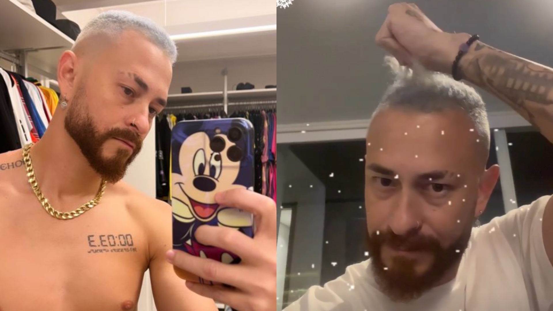 Fred choca fãs ao mostrar cabelo caindo depois de descolorir