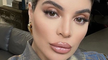 GKay remove preenchimento labial e fala sobre resultado: “Estranho”