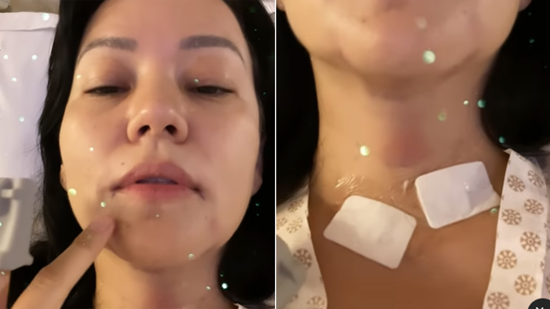 Geovanna Tominaga passa por cirurgia para remover tumor