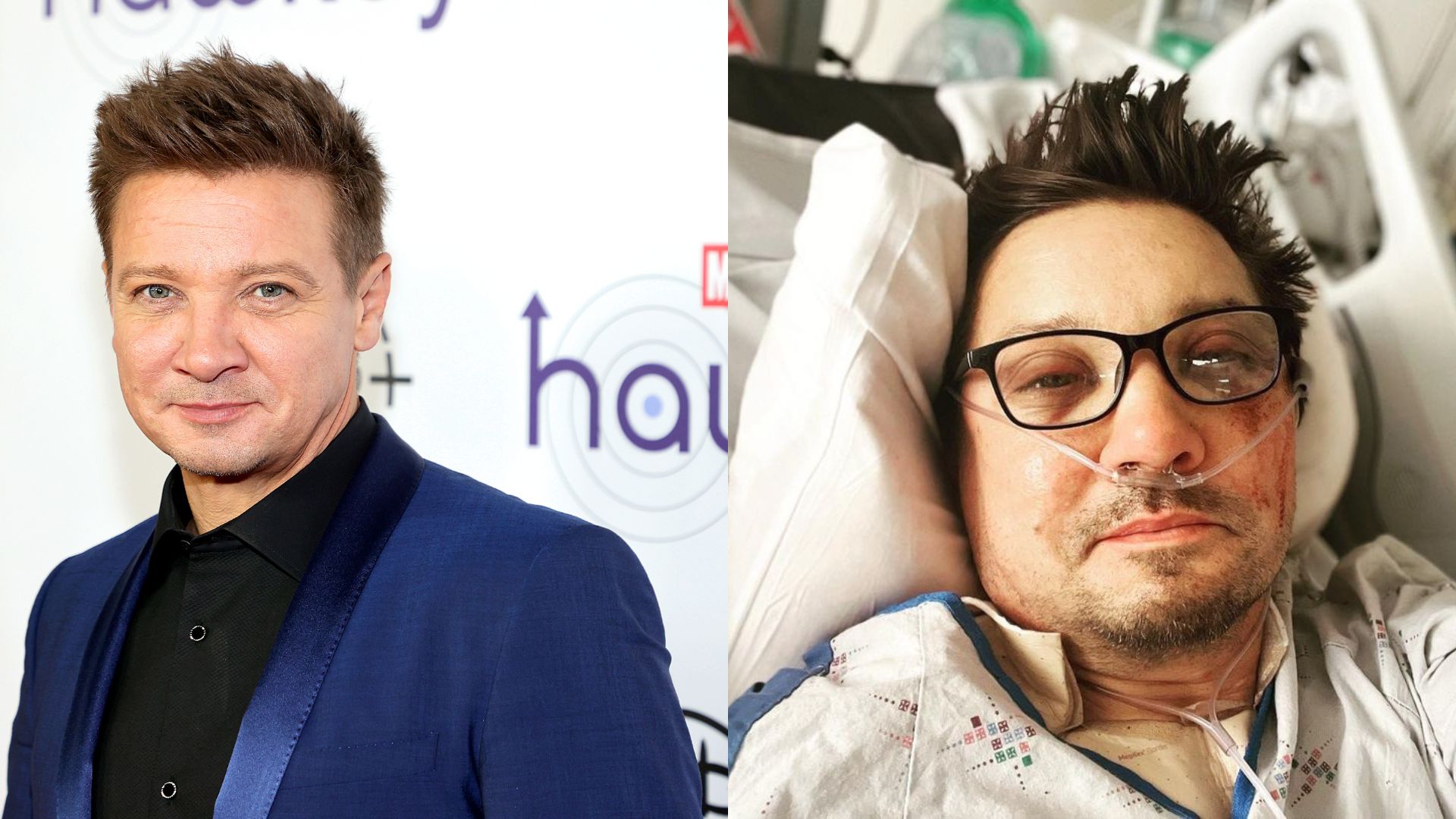 Jeremy Renner recebe alta do hospital, após acidente com trator de neve