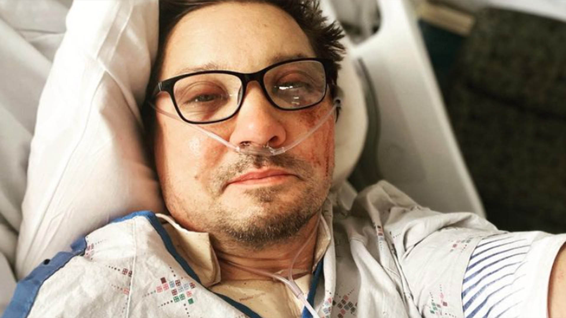 Jeremy Renner sofreu acidente para salvar outra vida