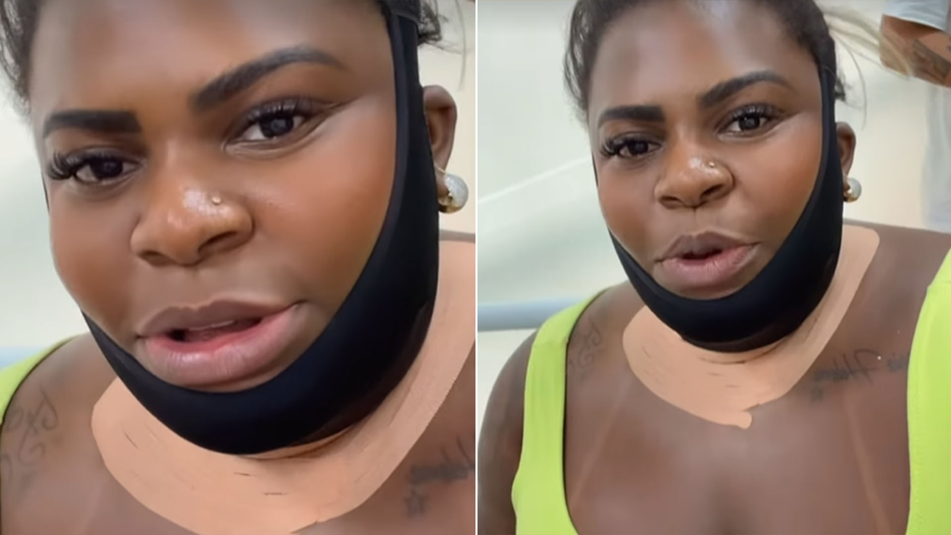 Jojo Todynho faz procedimento nos dentes e na papada