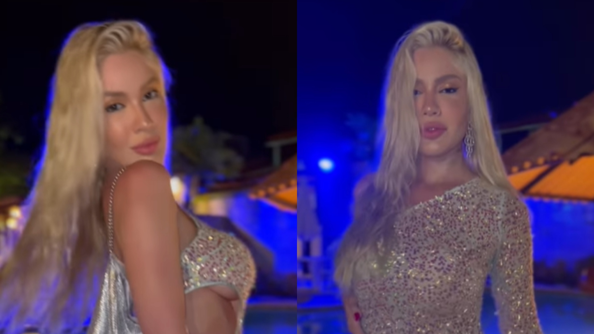Karoline Lima sofre acidente com box do banheiro e mostra ferimentos