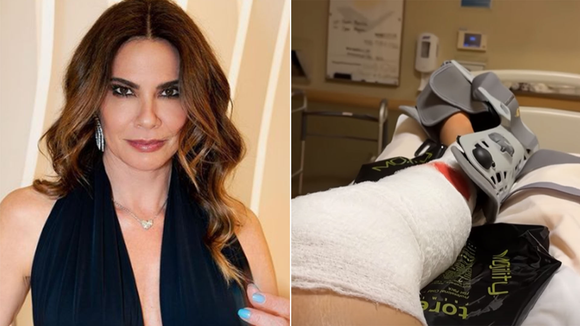 Luciana Gimenez fala pela primeira vez sobre acidente na neve: ‘um pouco cansada’