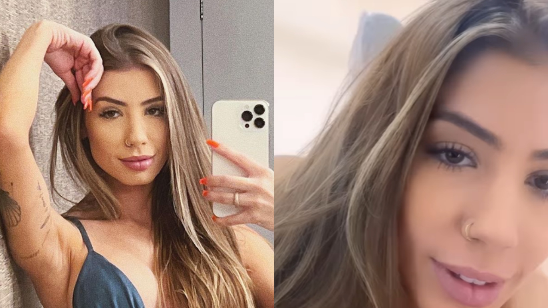 Maria Lina realiza procedimento estético no bumbum