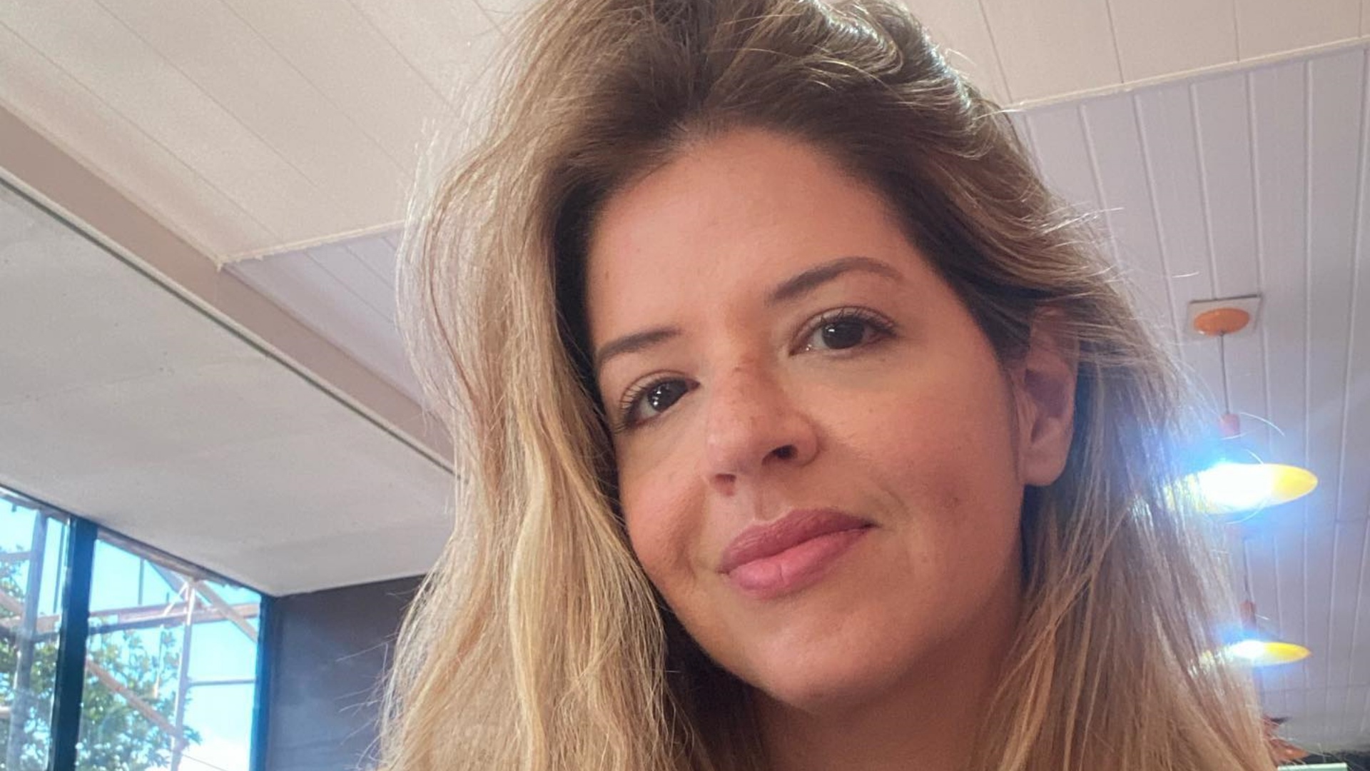 Mariana Santos tranquiliza os fãs após passar por cirurgia na boca