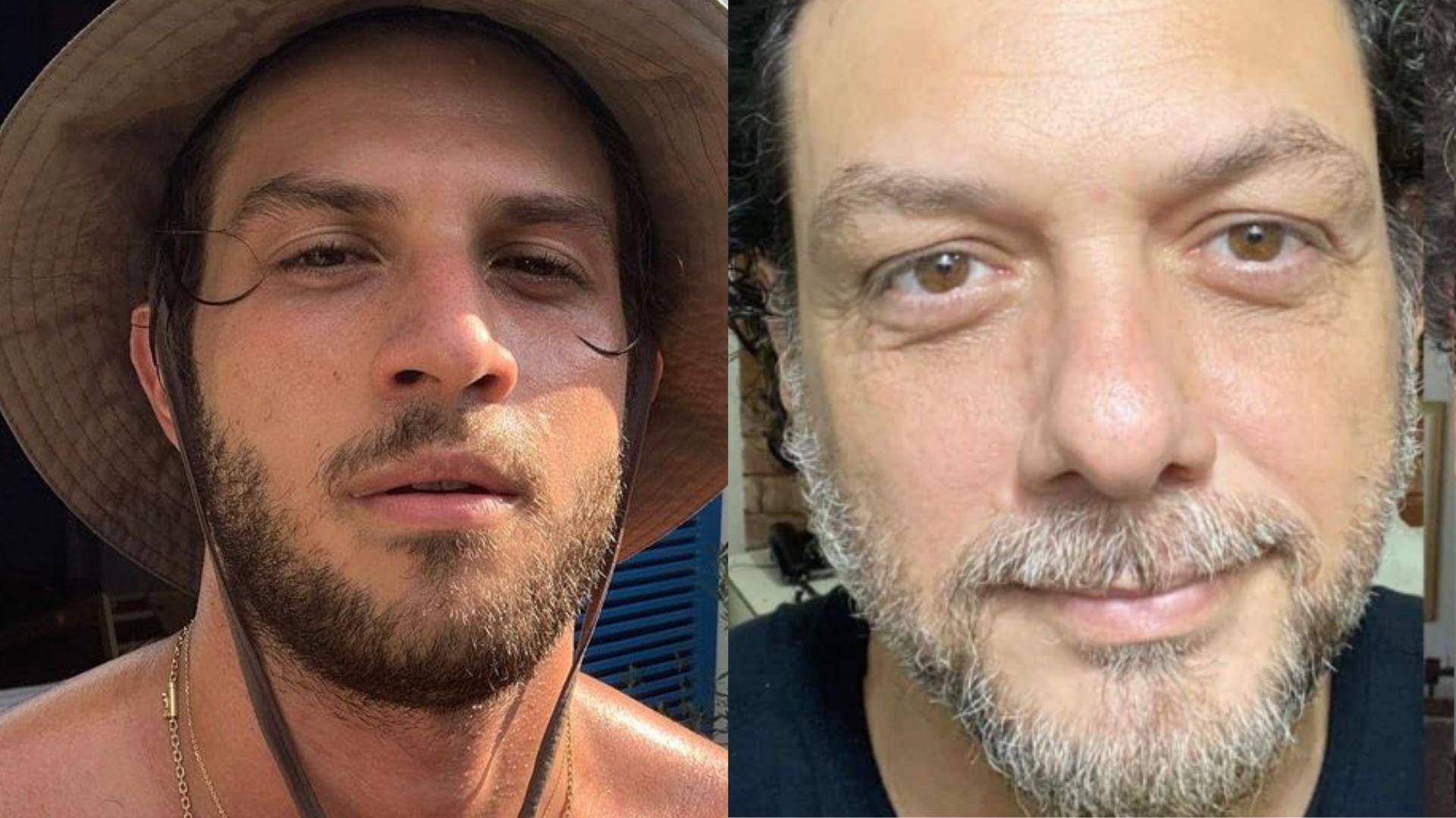 Pai de Chay Suede surge irreconhecível após harmonização facial: “Botox!”