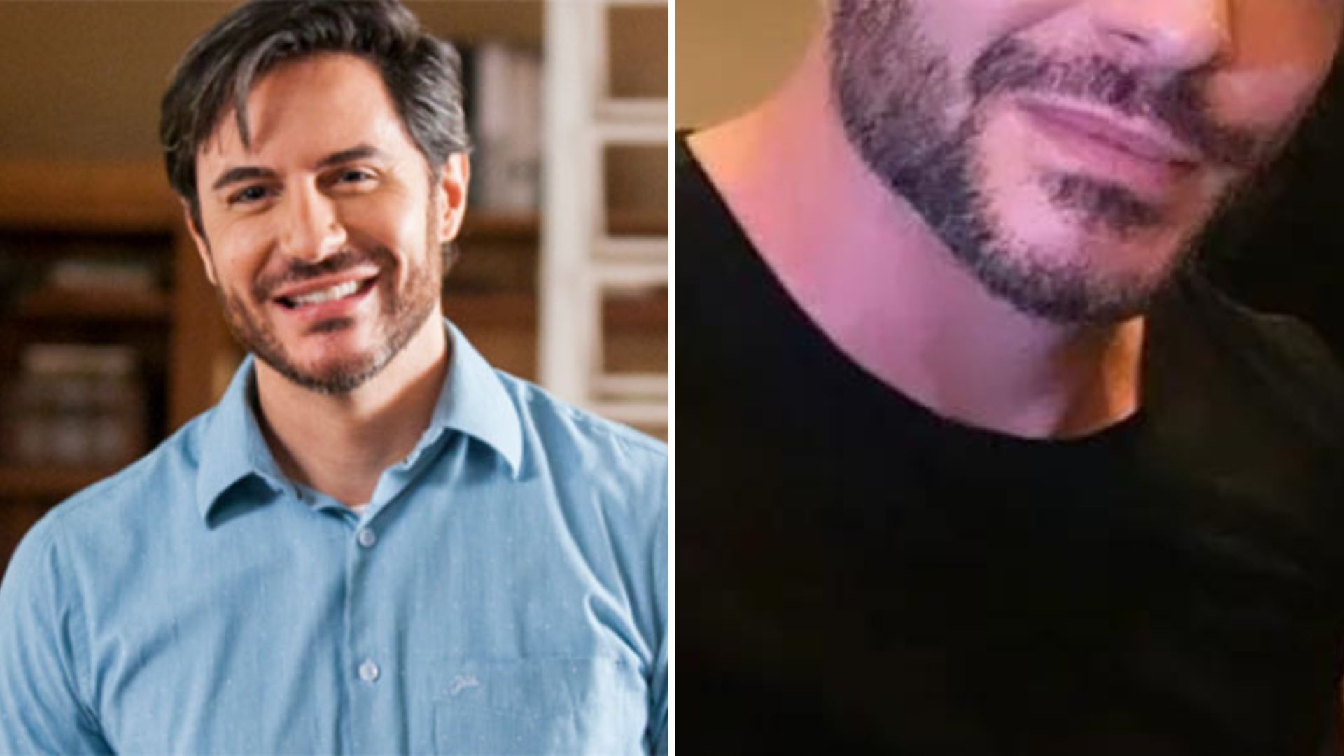 Ricardo Tozzi surge com o rosto irreconhecível e assusta fãs: “O que aconteceu?”