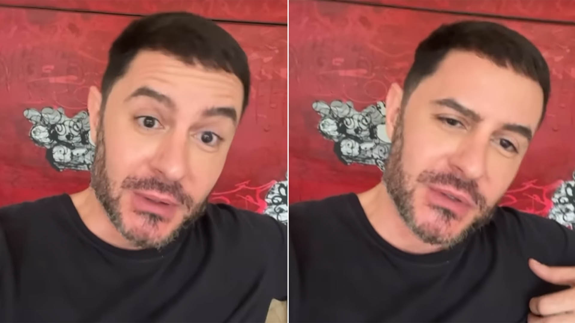 Ricardo Tozzi rompe o silêncio após rumores de harmonização facial