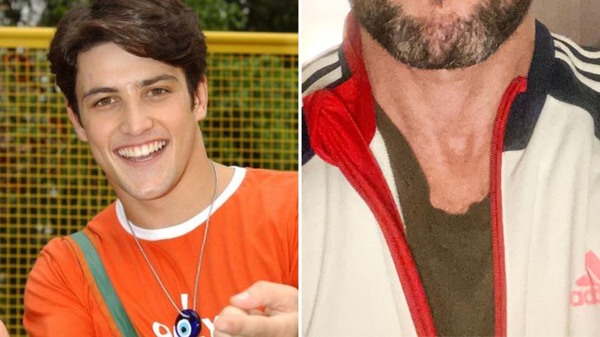 Lembra dele? Ex-galã de ‘Malhação’ é atacado por visual envelhecido: “É você?”