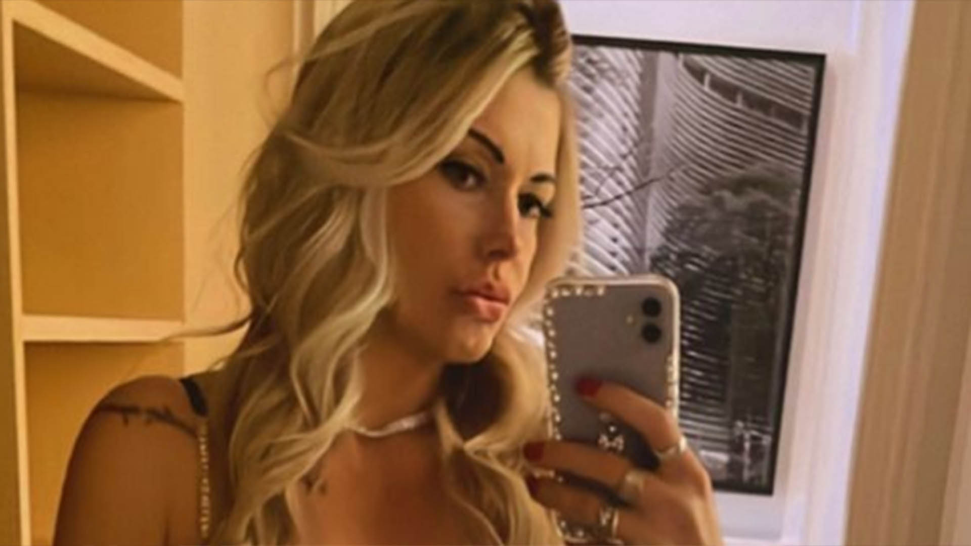Ex-BBB revela medo da morte ao ir parar na UTI: ‘Chorei muito’