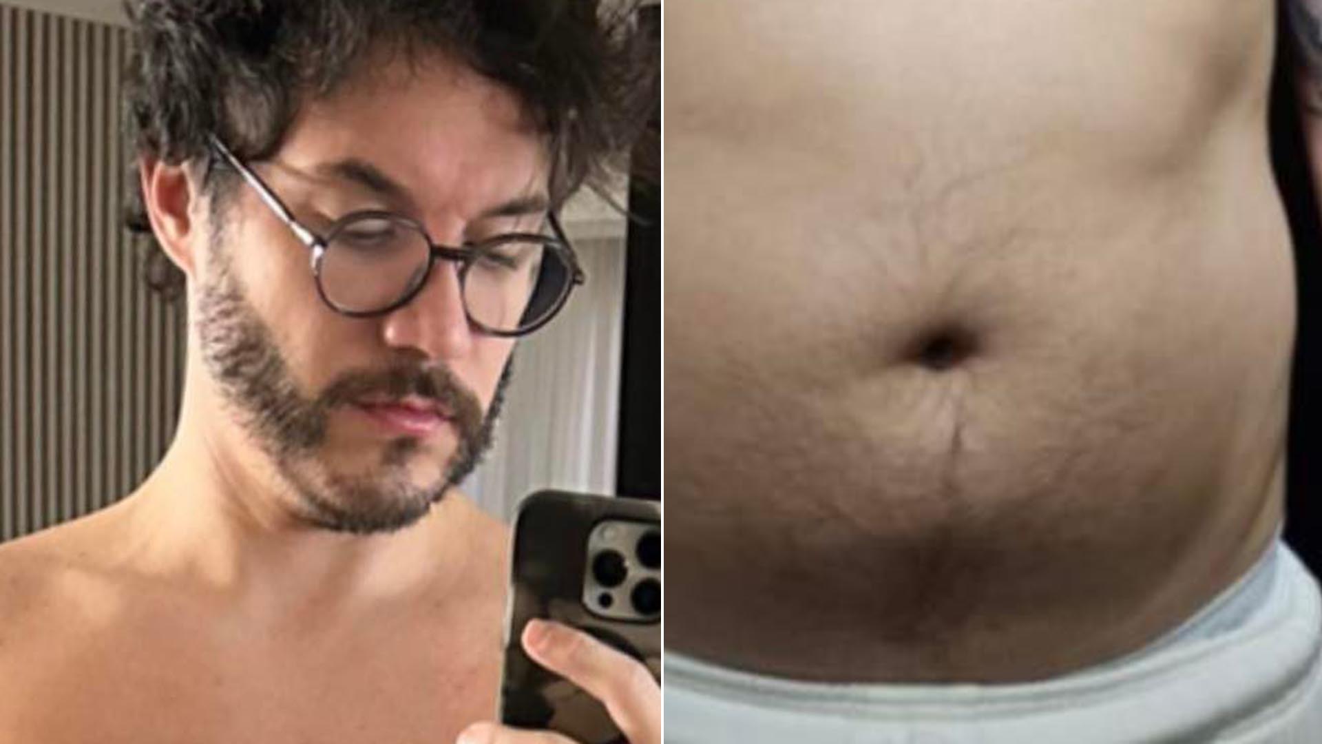 Tá magro! Ex-BBB Eliezer exibe antes e depois da transformação em seu corpo