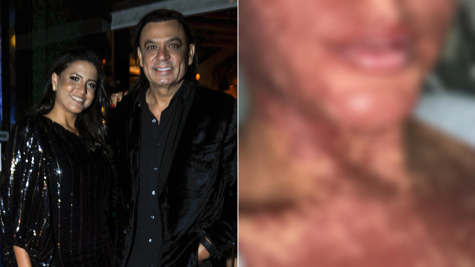 Mulher de Frank Aguiar exibe o corpo coberto de manchas: ‘Grave’