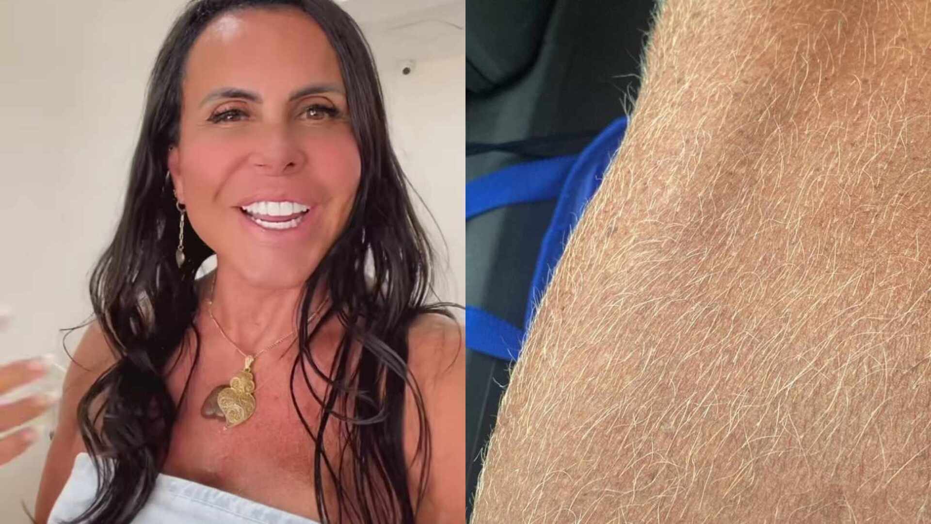 Gretchen chama a atenção ao mostrar perna com pelos loiros: ‘Bem feito’