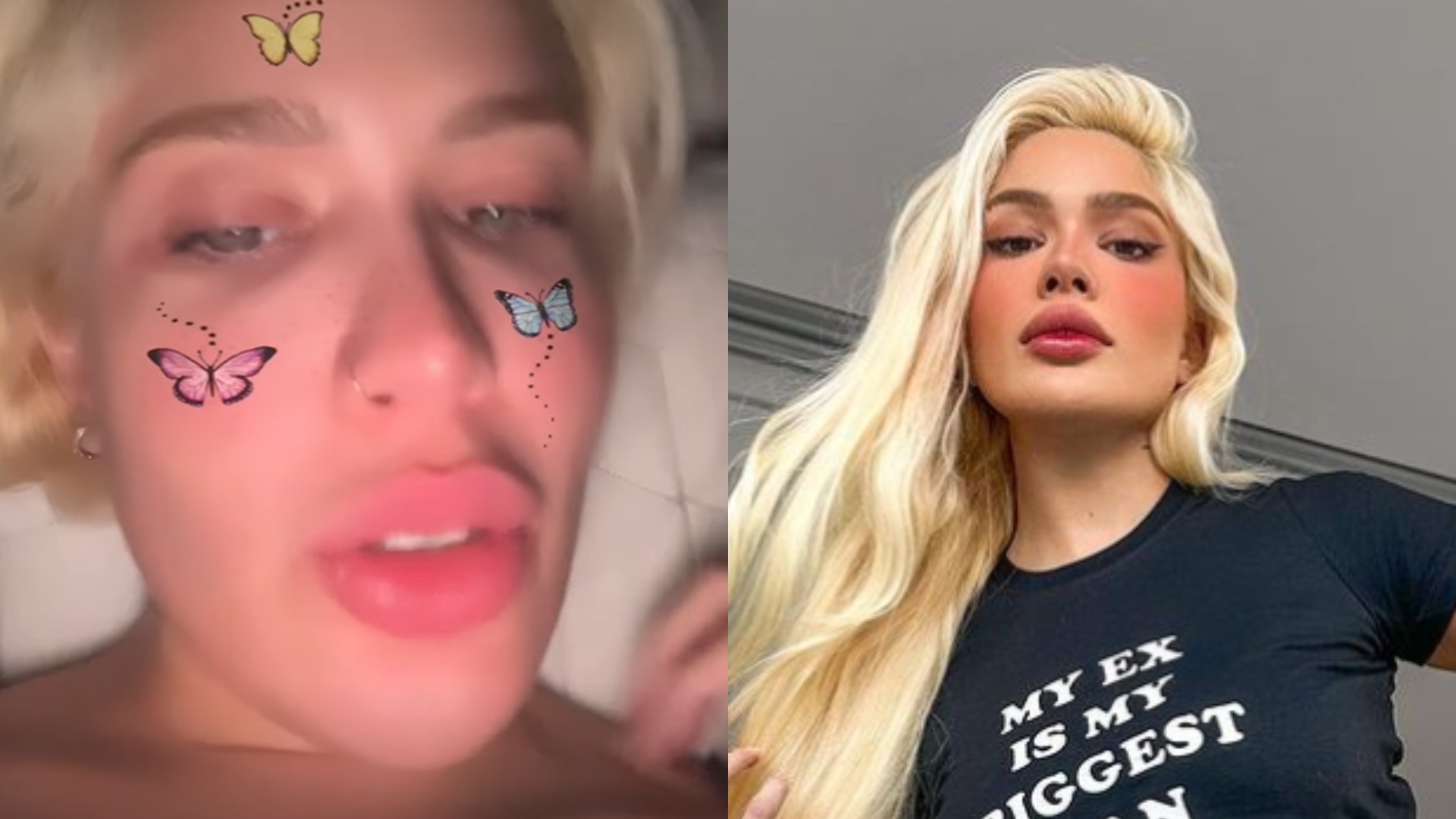 Karoline Lima choca ao mostrar fotos de antes da fama: ‘Como era feia’