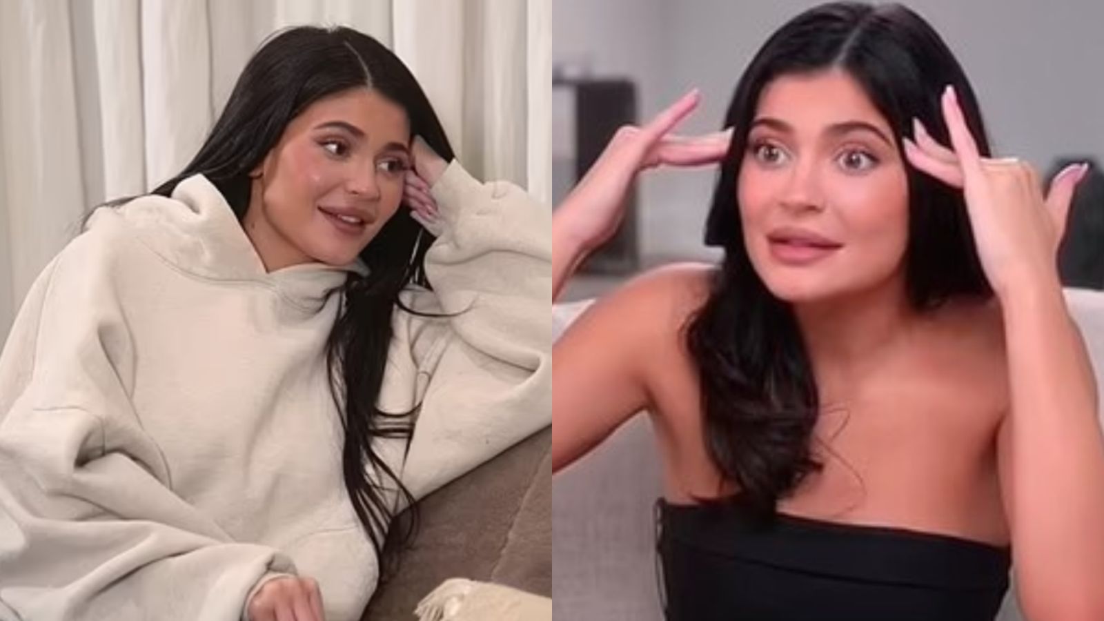Kylie Jenner surpreende ao confessar cirurgia plástica secreta: ‘Gostaria de nunca ter feito’