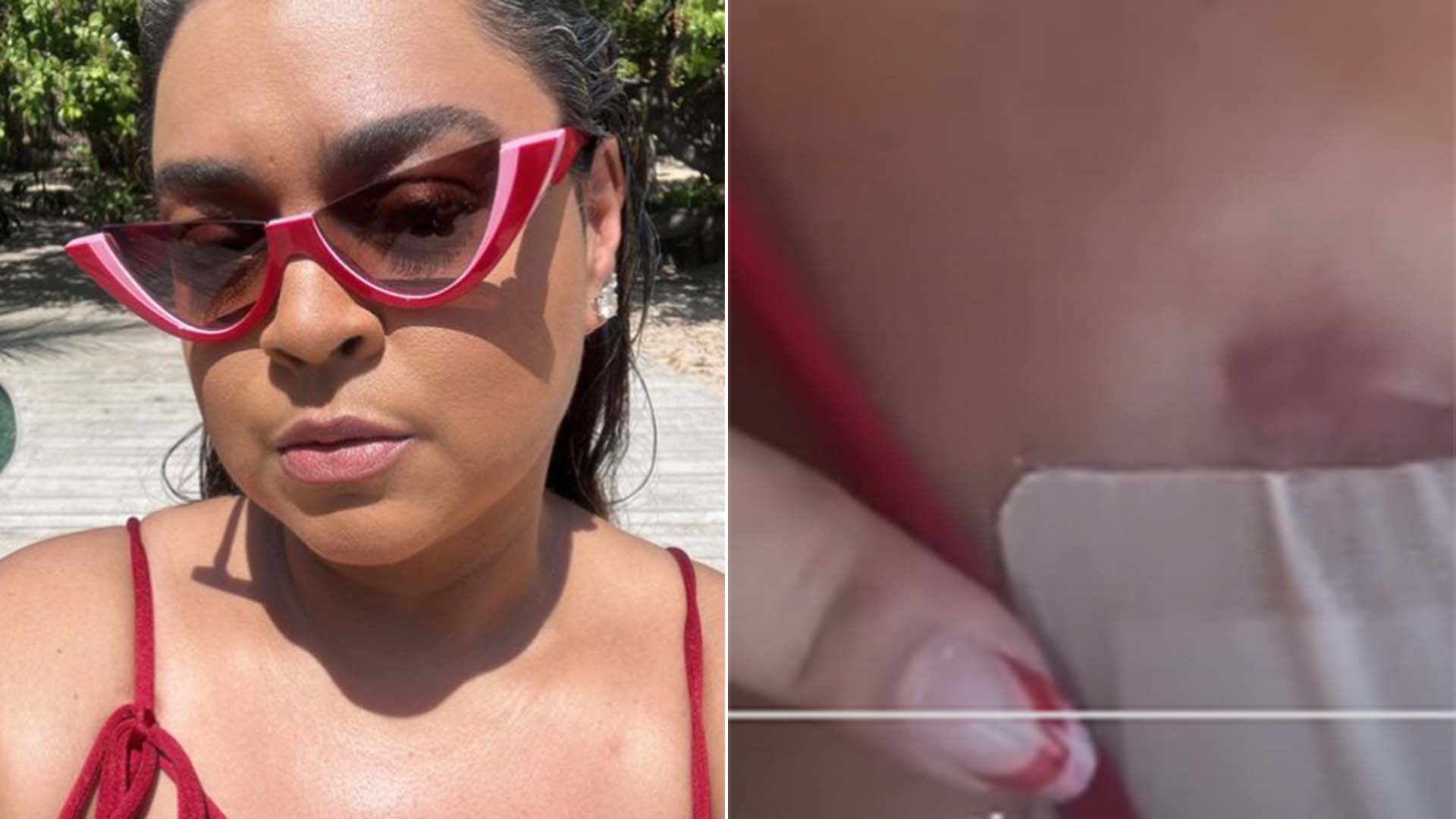 Preta Gil explica o que é a cicatriz no seu tórax: ‘Muita gente pergunta’