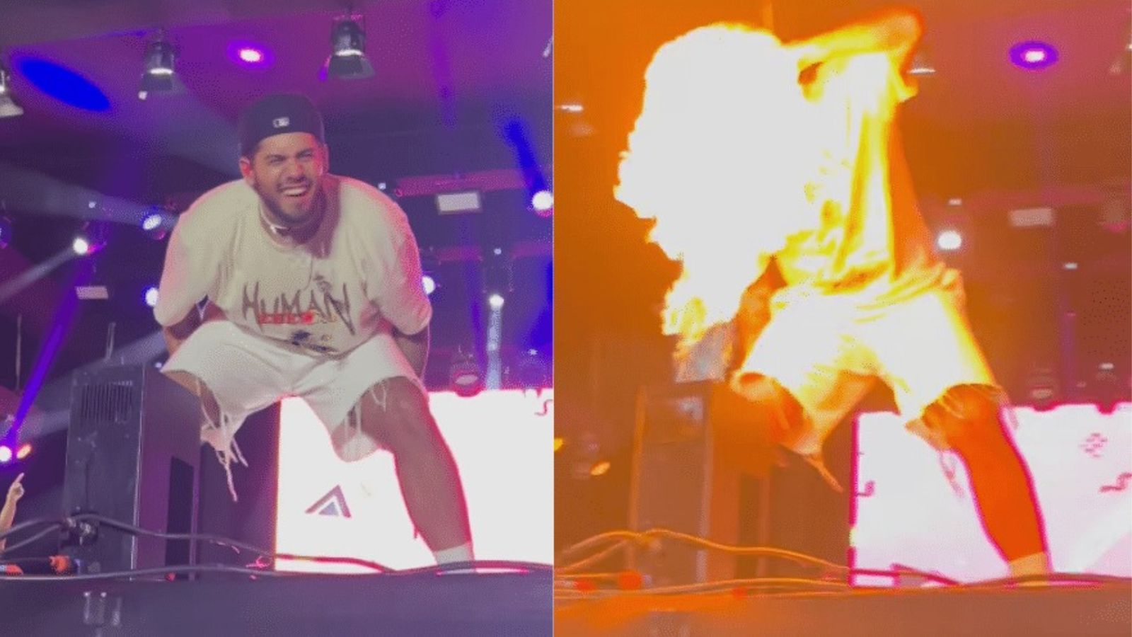 Que perigo! Zé Felipe tem rosto atingido por chamas durante show