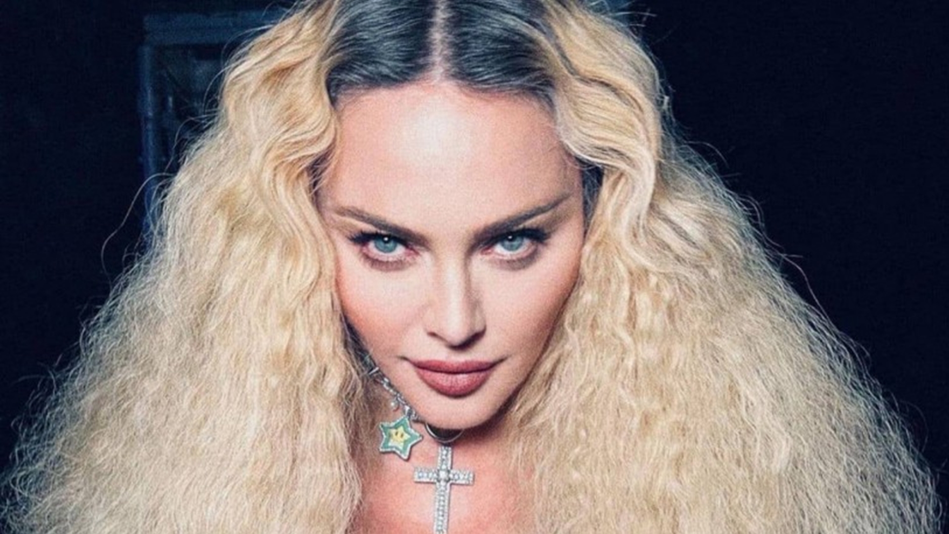 O que aconteceu com Madonna? Saúde de cantora afetou nova turnê