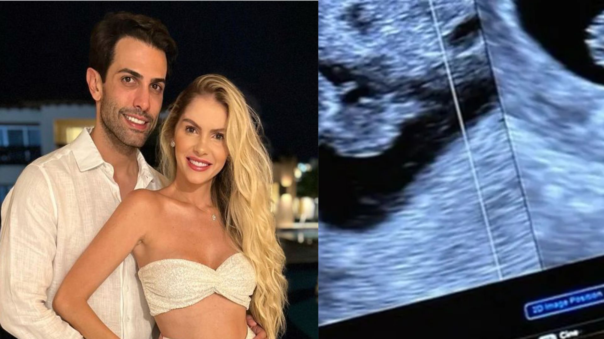 Bárbara Evans encanta ao mostrar ultrassom dos gêmeos pela primeira vez