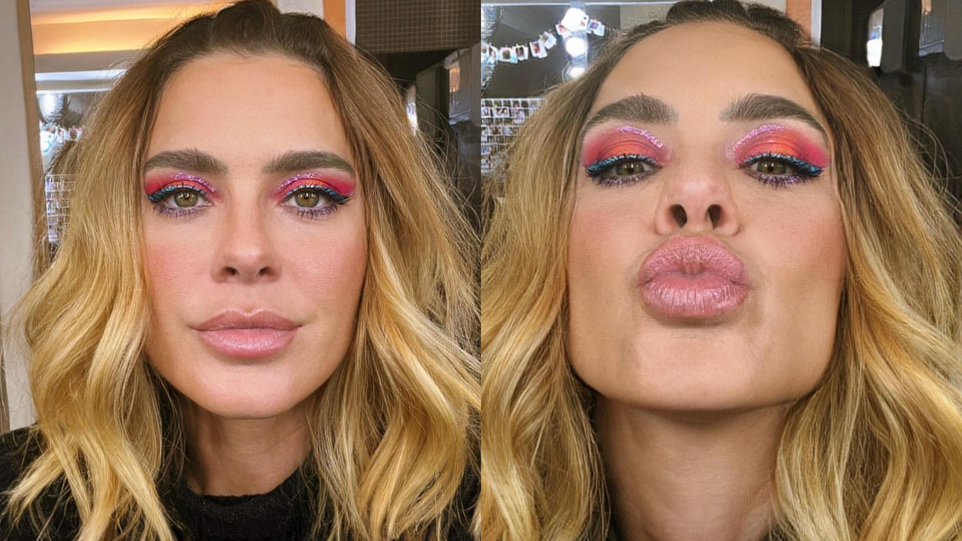 Carolina Dieckmann fez harmonização? Especialista avalia visual da atriz