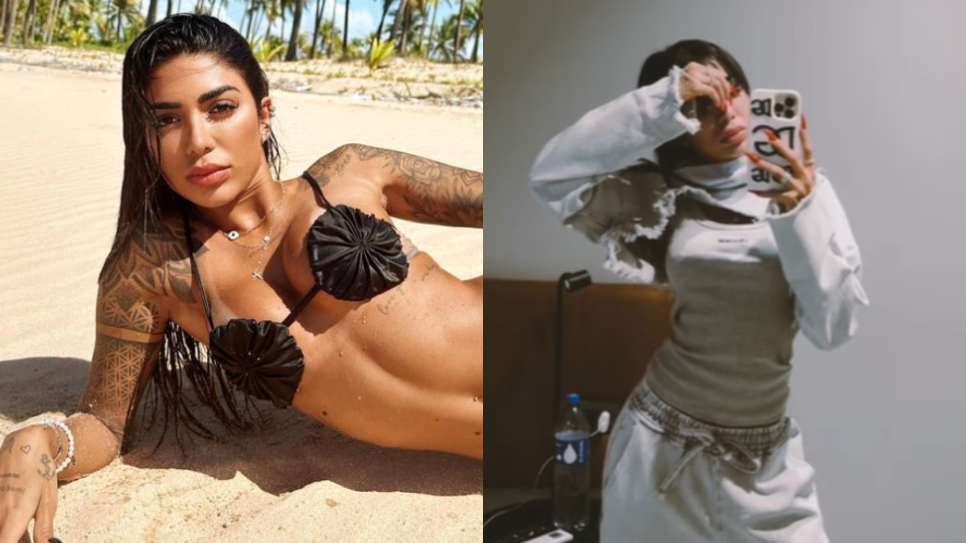 Dhiovanna Barbosa descobre problema de saúde durante pós-operatório de endometriose
