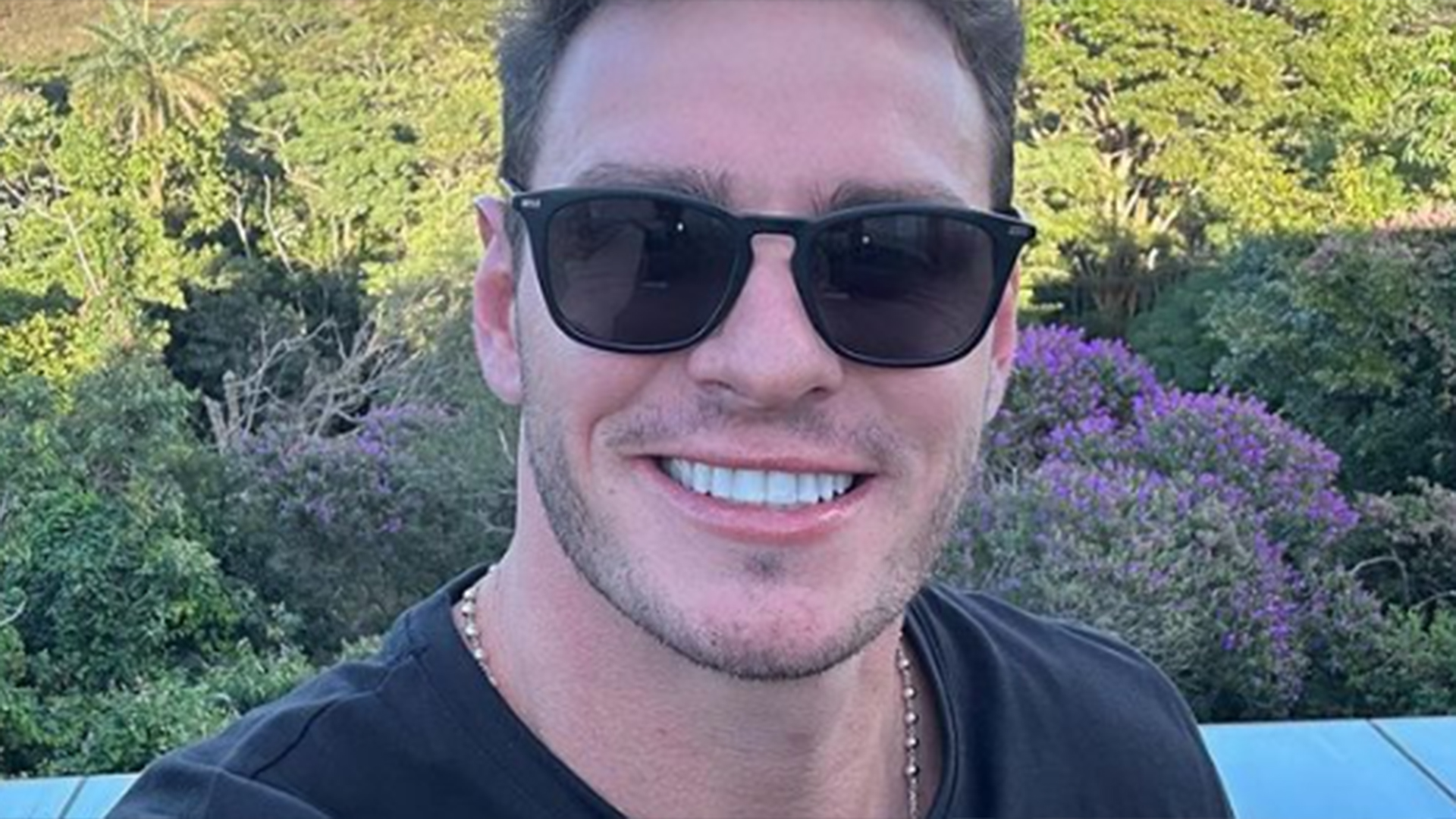 Ex-BBB Gustavo Cowboy faz harmonização facial e surge em fotos de antes e depois
