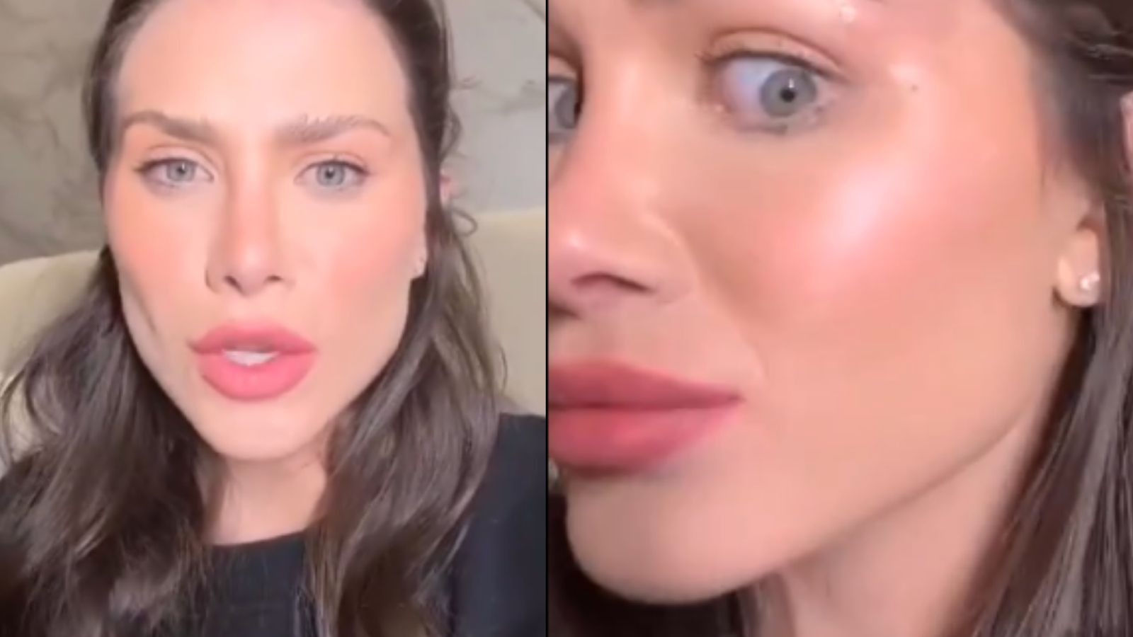 Flavia Pavanelli desabafa após sofrer queimadura no rosto: “Doendo”