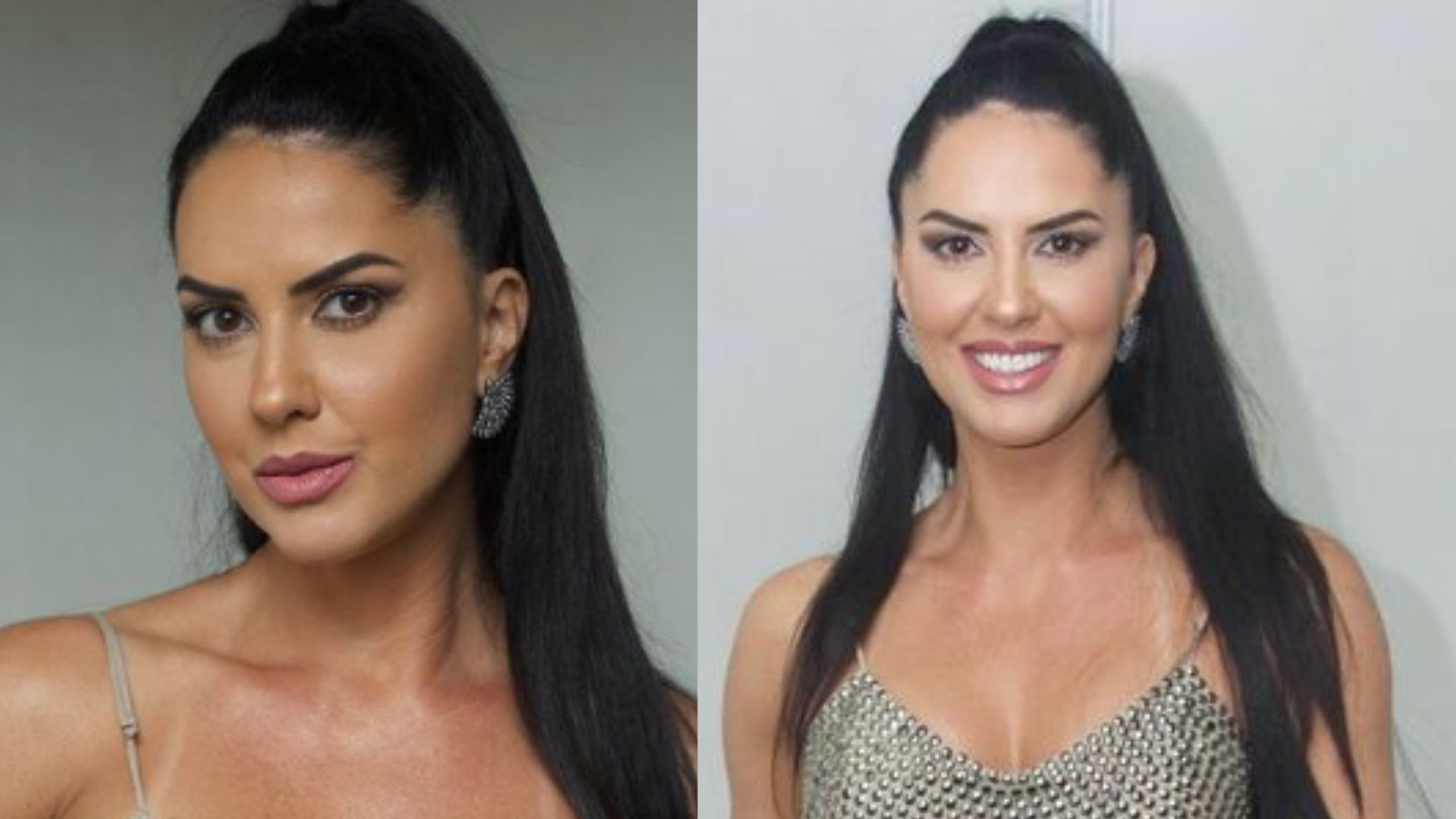Graciele Lacerda explica mudança ao surgir com o rosto diferente