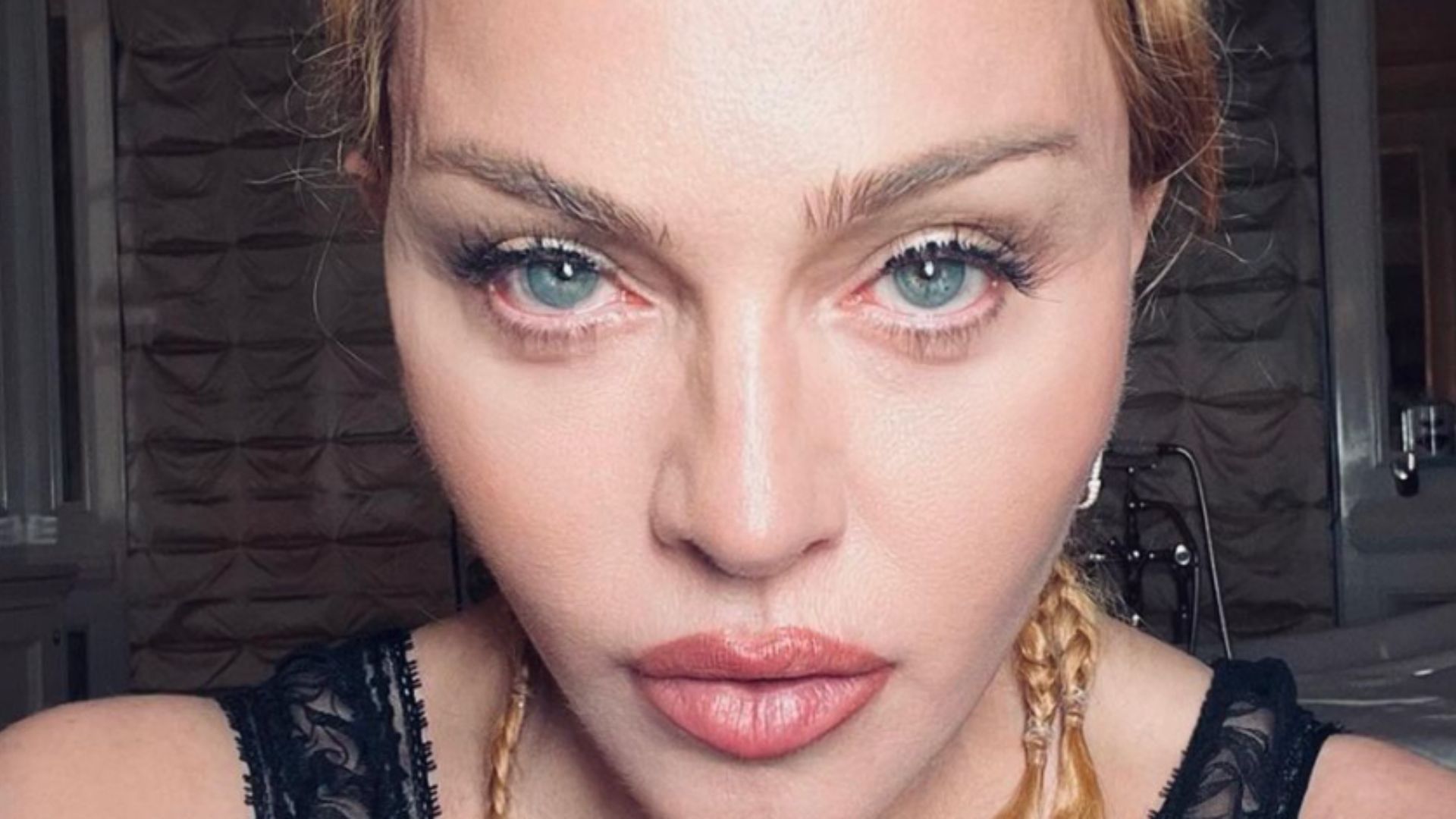 Aos 64 anos, Madonna preocupa fãs ao ser internada na UTI; veja comunicado