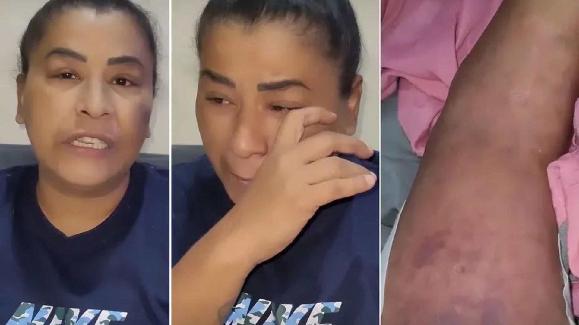 Na fila do SUS, cantora MC Kátia pede ajuda para voltar a andar: “Muita dor”
