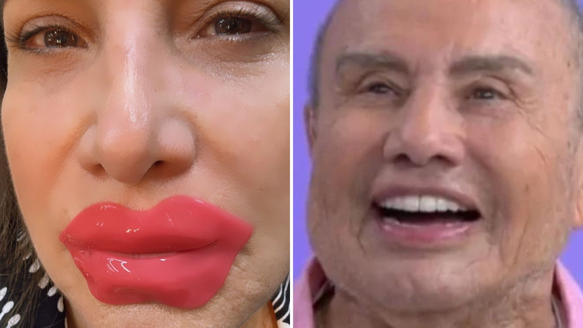 Indireta? Totia Mirelles debocha após harmonização facial de Stênio Garcia: “Venenosa”