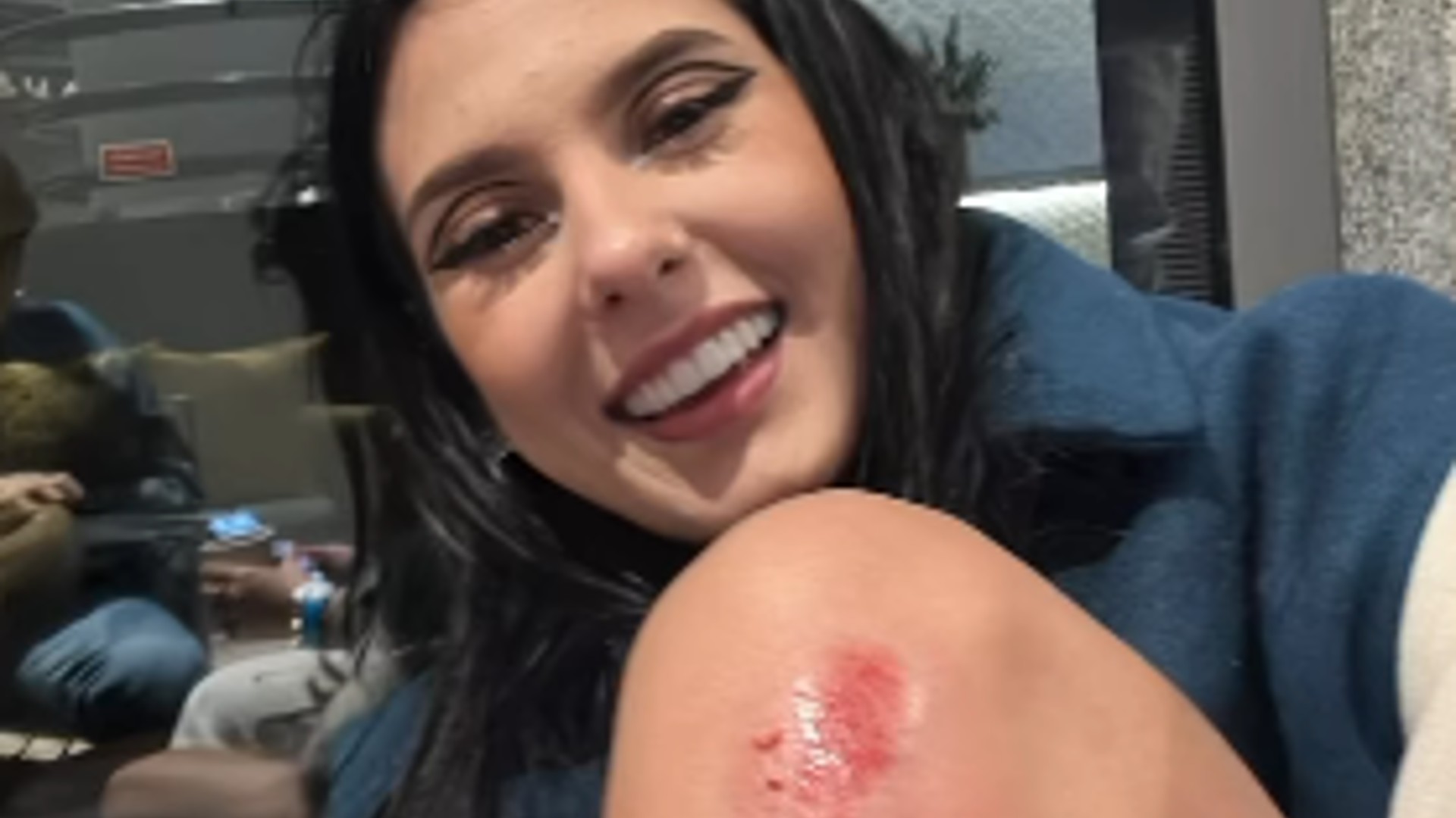 Ana Castela sofre acidente ao andar de patine com Gustavo Mioto em Portugal