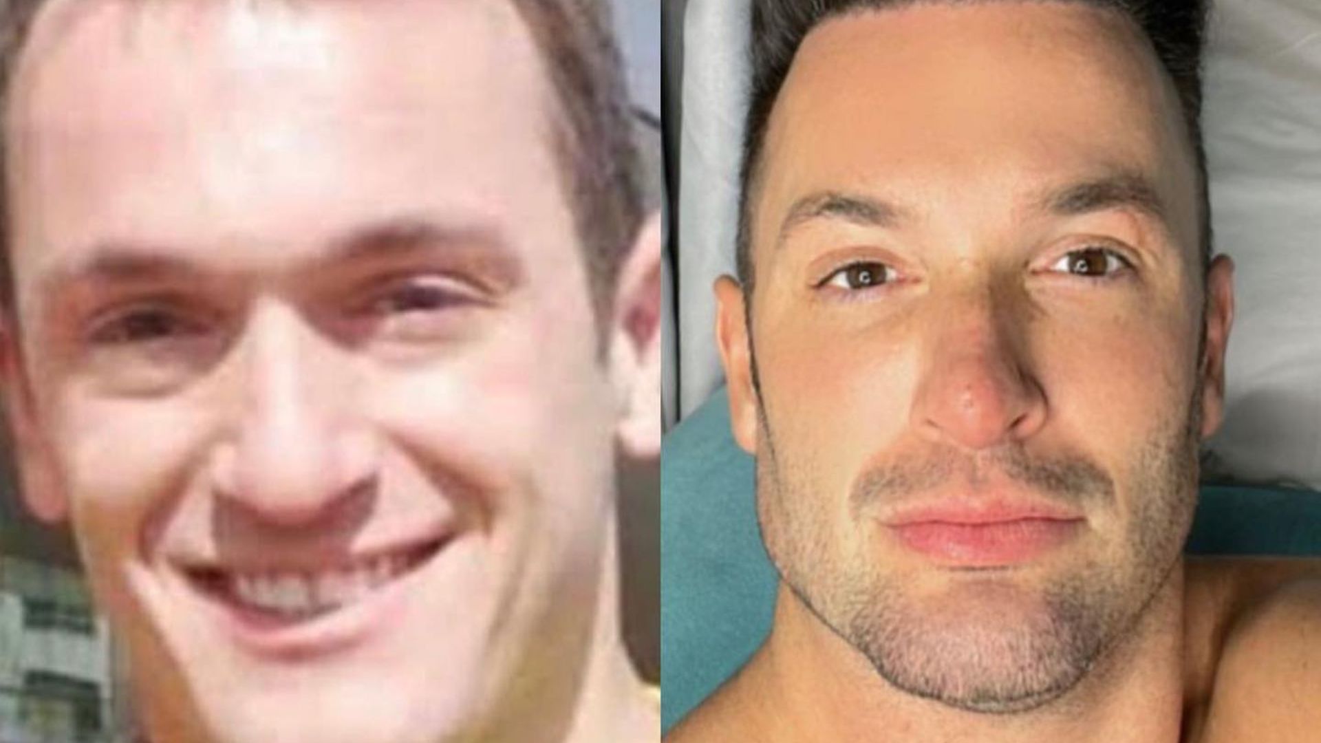 De Diego Hypólito a Eliezer, veja antes e depois de famosos que fizeram harmonização facial