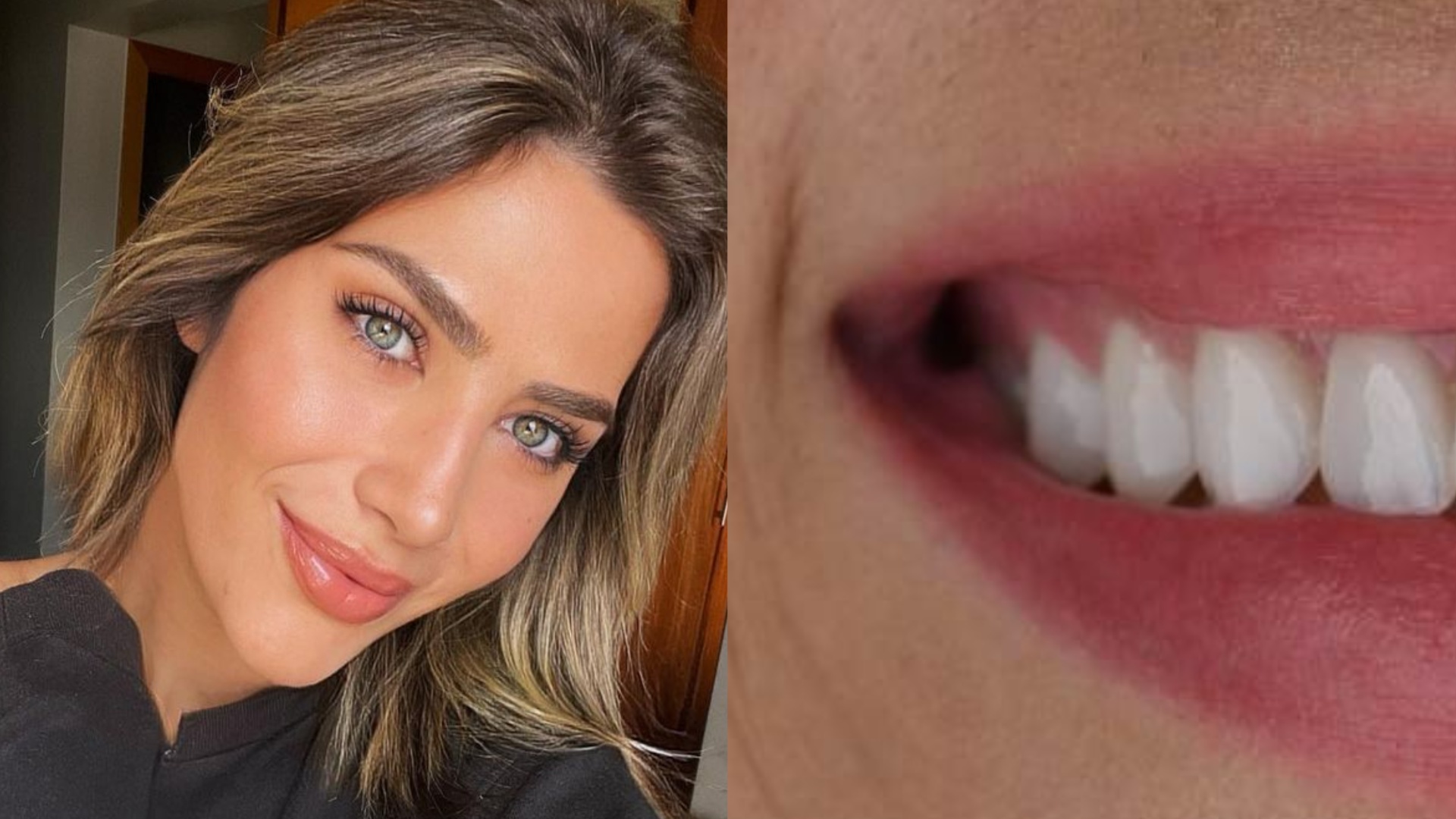 Jéssica Costa choca com novo sorriso de R$ 30 mil: ”Amei”