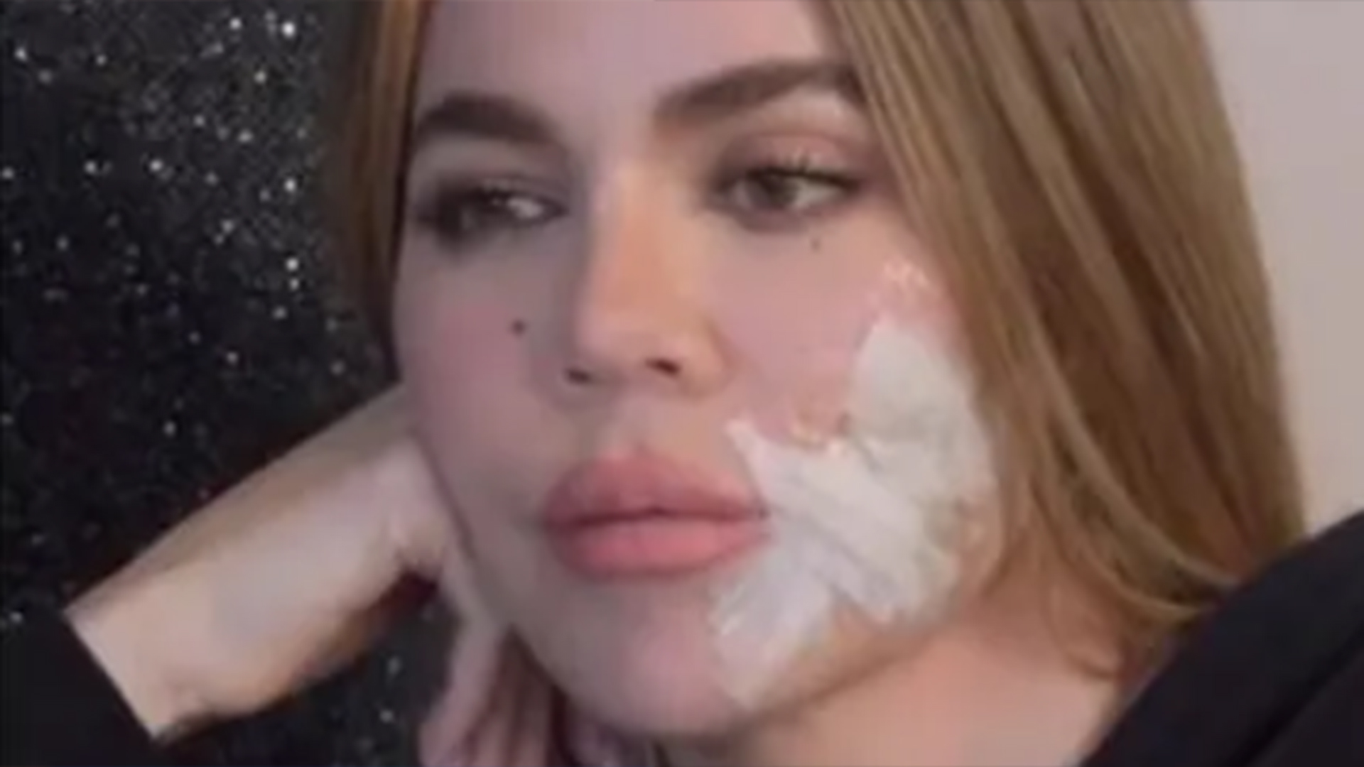 Khloe Kardashian mostra corte no rosto após cirurgia