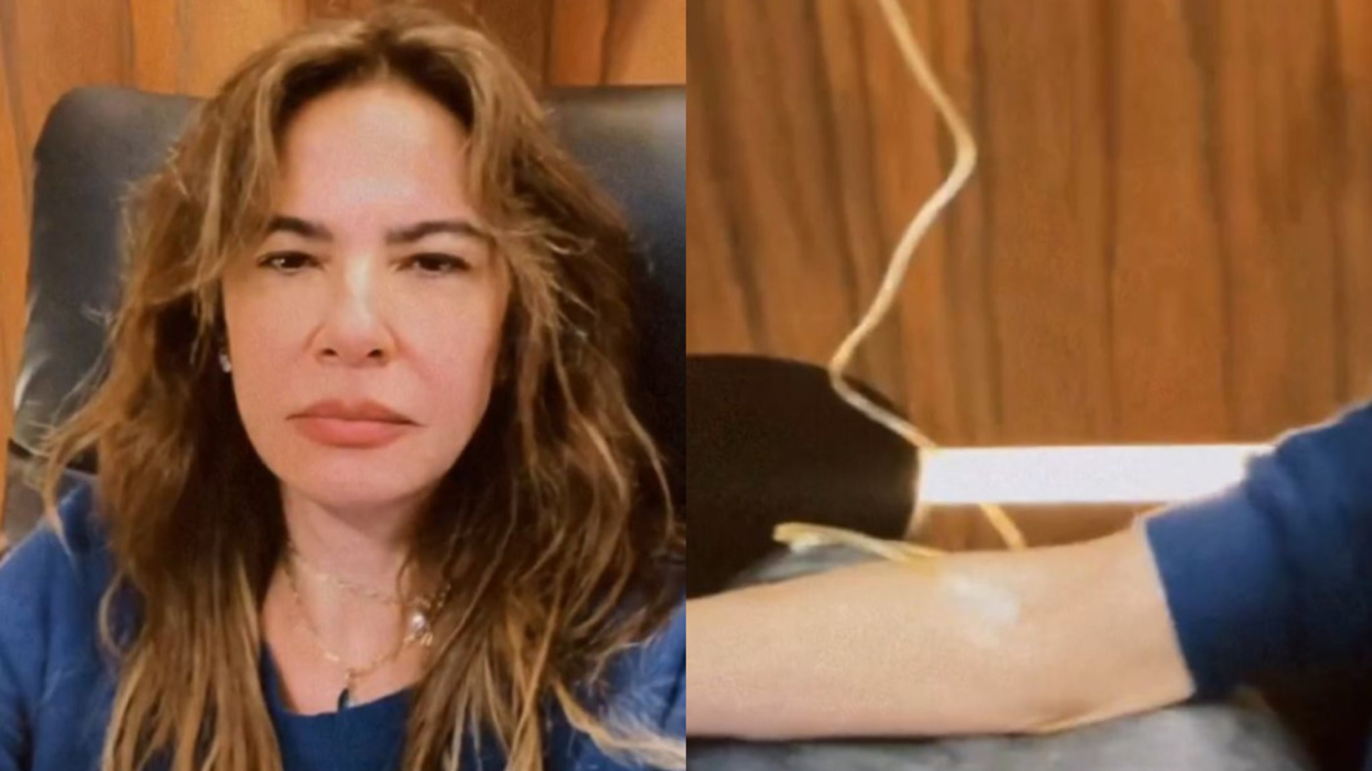 Luciana Gimenez atualiza seu estado de saúde e recuperação de grave acidente: “Debilitada”