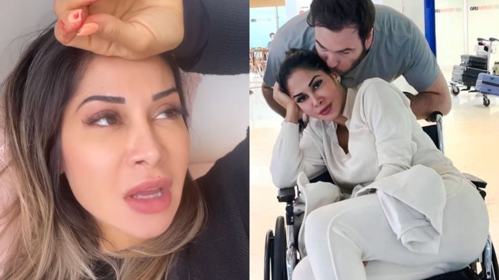 Sem andar, Maíra Cardi desabafa sobre problema grave na coluna: “Vou ter que operar”