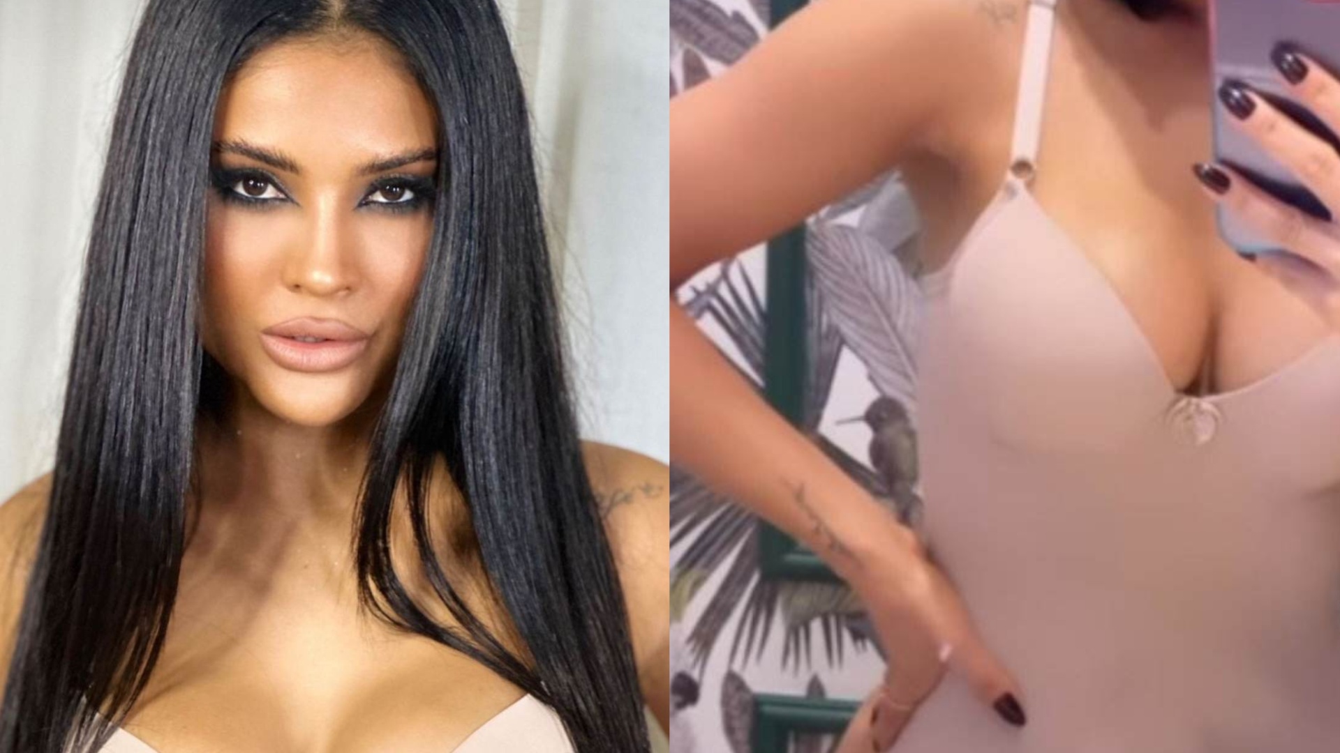 De lingerie, Mileide Mihaile exibe corpo marcado após lipo