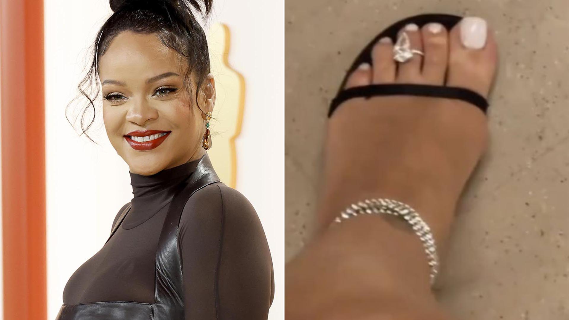 Rihanna usa anel de diamante no dedo do pé. Saiba qual é o valor da joia!