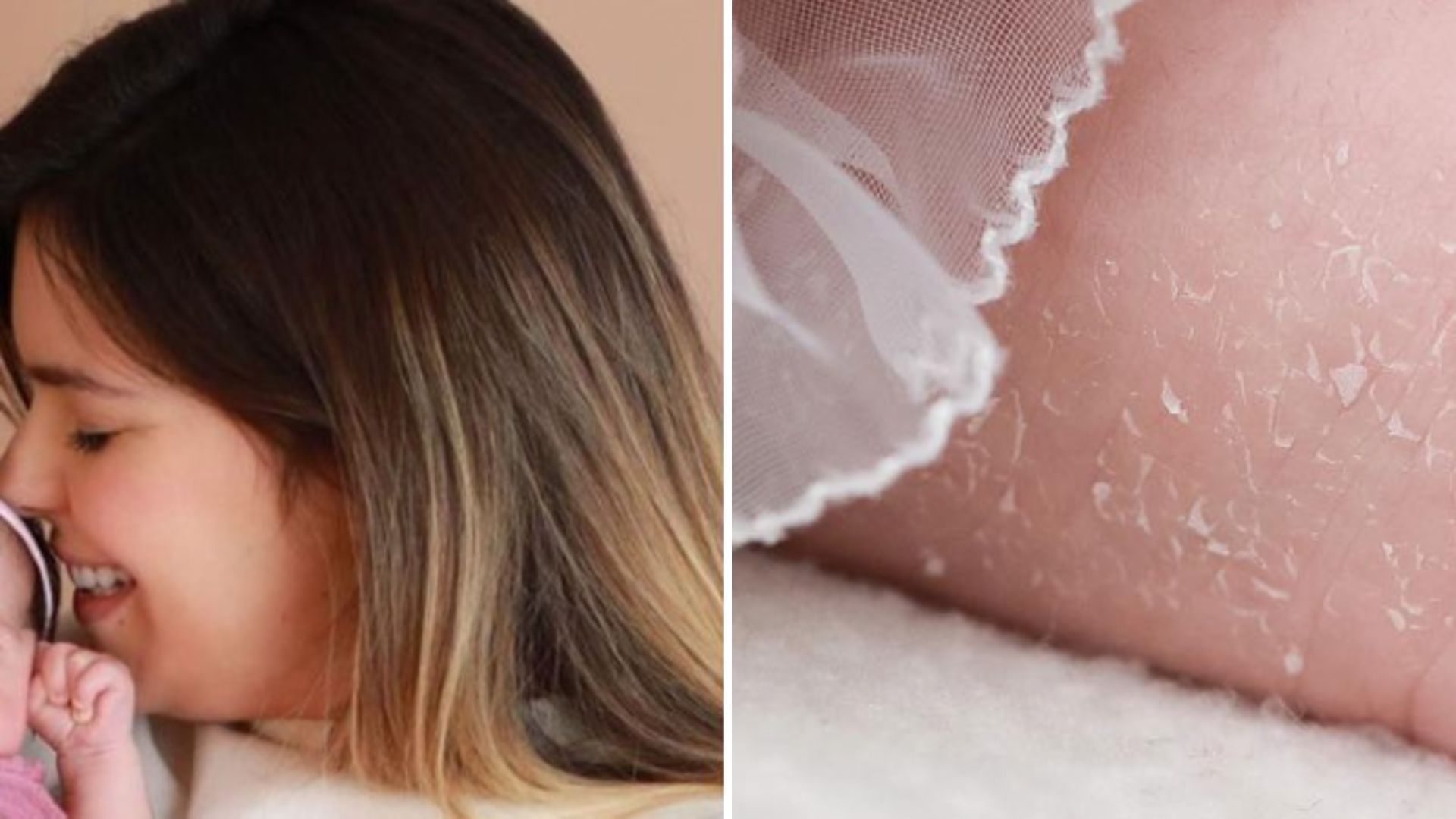 Viih Tube mostra detalhes da filha e justifica pele descascando: “Faz parte”
