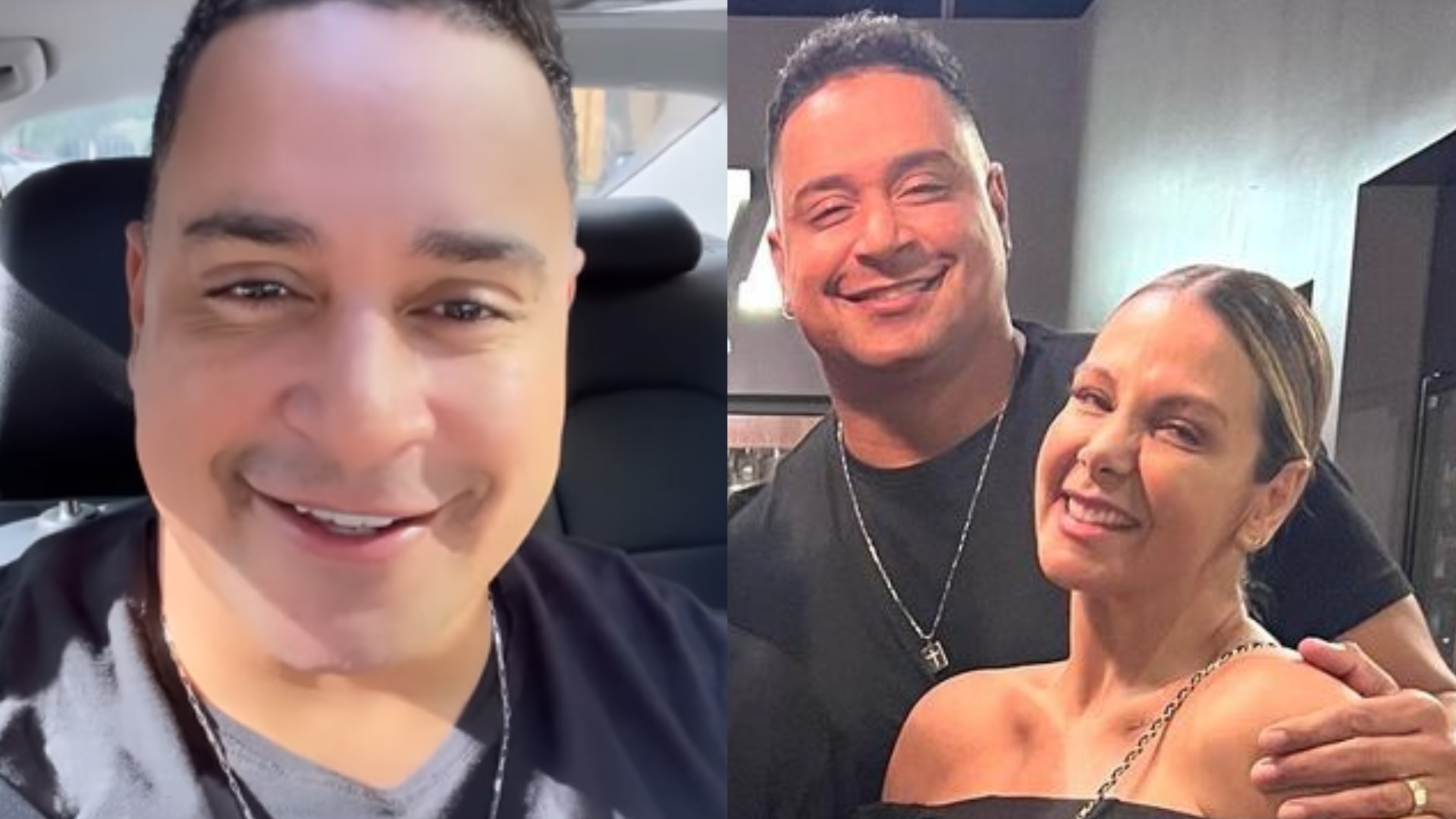Xanddy faz procedimento no rosto e brinca com comentário da mulher, Carla Perez