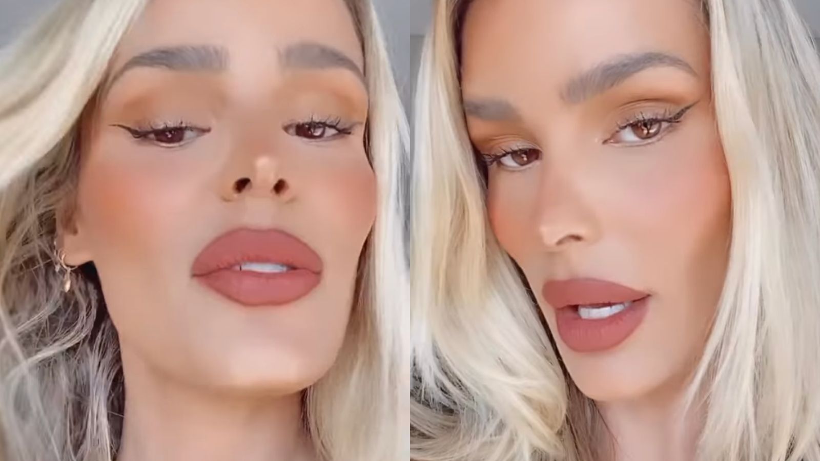 Yasmin Brunet sofre acidente de carro e culpa ‘eclipse’