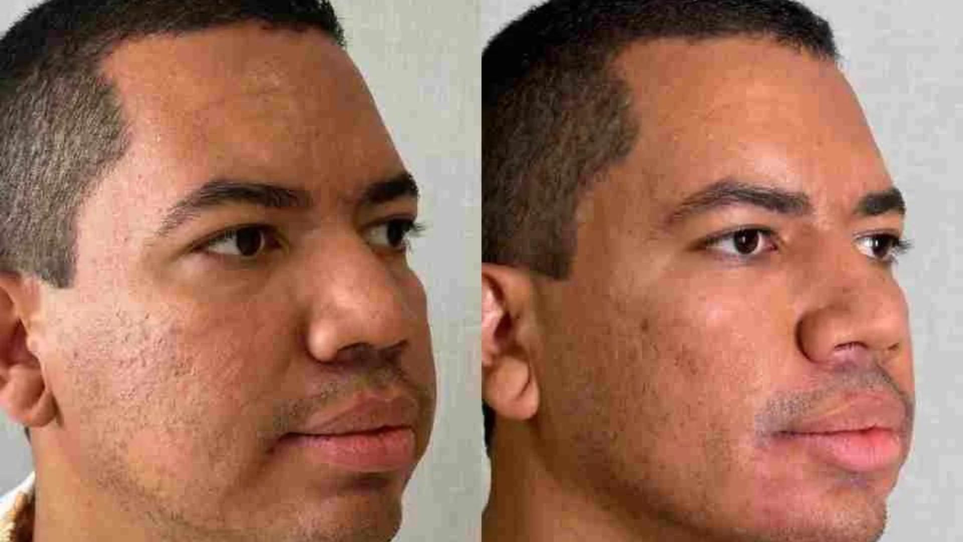 Bruno Gaga desabafa após críticas ao novo visual: “Valorizou minha beleza”