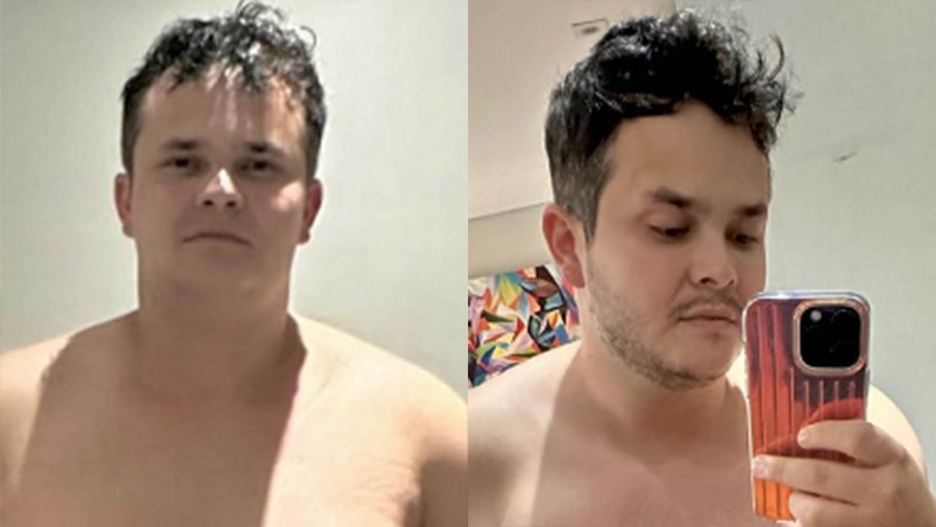 Matheus, da dupla com Kauan, choca com antes e depois de sua barriga