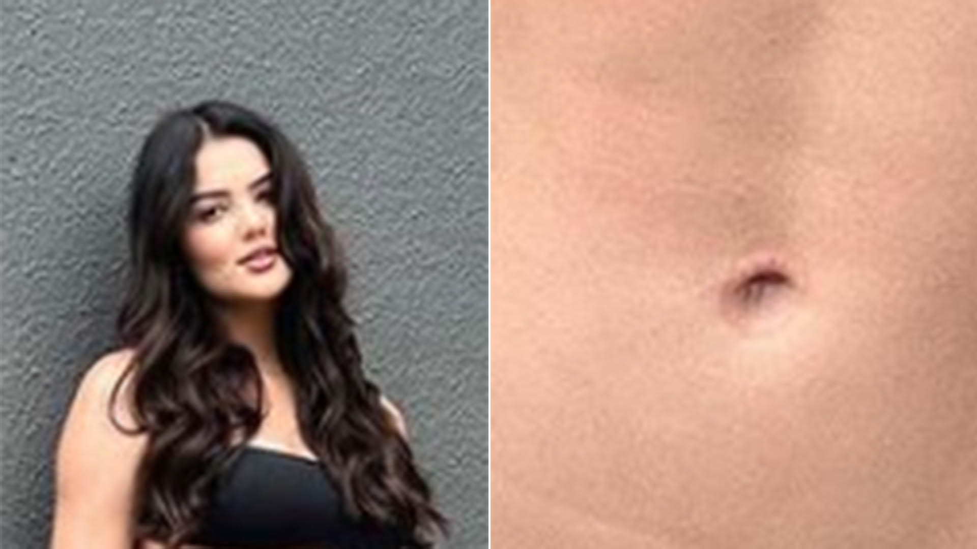 Ex-BBB Eslovênia exibe o resultado da Lipo LAD em fotos de biquíni